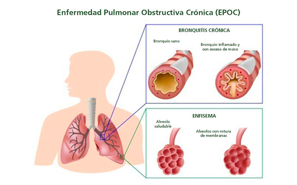 Foto de Kern Pharma