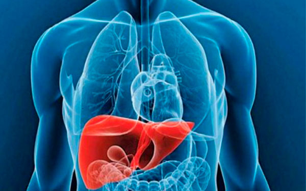 Se&ntilde;ales que alertan sobre la enfermedad de Gaucher