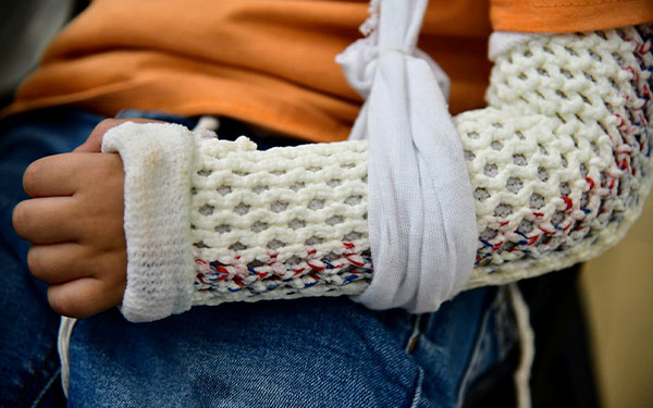 Casi la mitad de los ni&ntilde;os sufrir&aacute; una fractura antes de la adolescencia